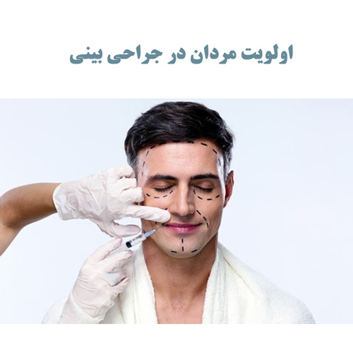 اولویت مردان در جراحی بینی