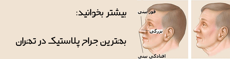 جراحی بینی مردانه