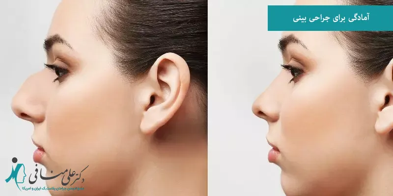 آمادگی برای جراحی بینی