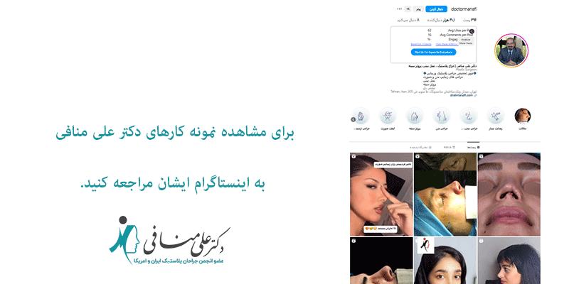 مشاهده-نمونه-کارها