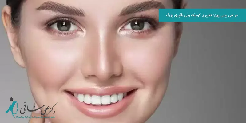 جراحی بینی پهن؛ تغییری کوچک ولی تأثیری بزرگ